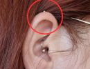 allergi piercing
