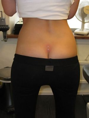 2 stk dermal piercing paa laenden 1600 1000