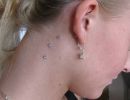 3 stk dermal piercing paa halsen 1600 1000